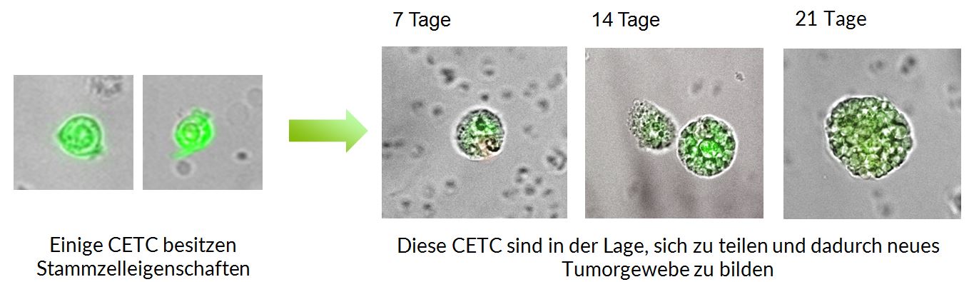 Tumorsphären - Entstehung von Metastasen