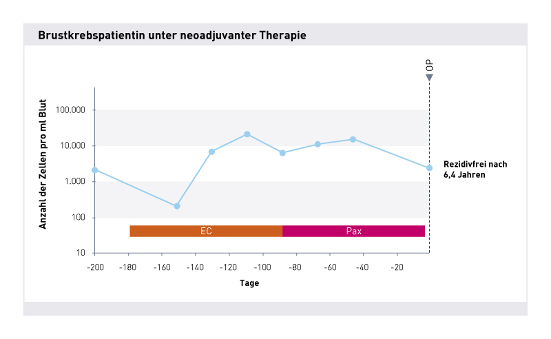 Absinkende Zellzahl in der neoadjuvanten Therapie